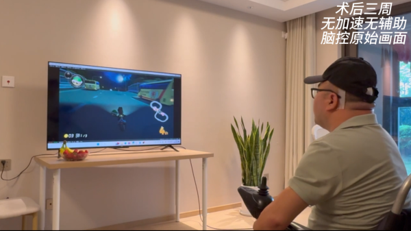 通盈证券 我国成功开展首例侵入式脑机接口临床试验